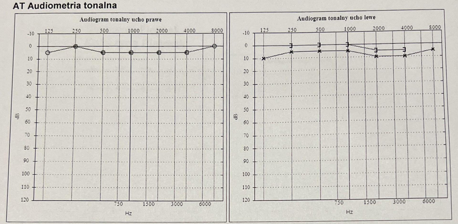 audiogram.jpg.f6722d51633fcd19a5dd683e3a3bc0ac.jpg