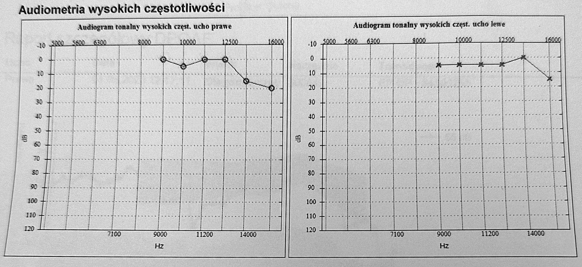 audiogram2.jpg.a11b10c6e147b0c4761aa114aba33a7e.jpg